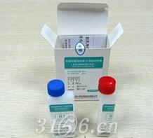 抗链球菌溶血素O测定试剂盒(胶乳增强免疫比浊法)招商