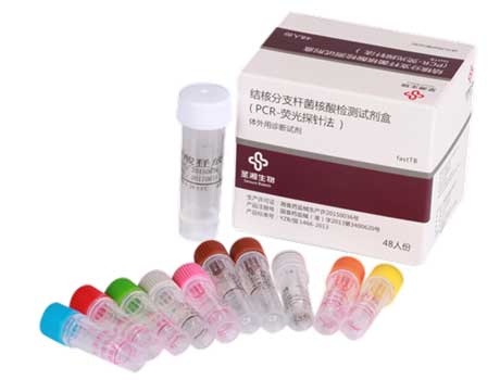 圣湘 结核分枝杆菌核酸检测试剂盒（PCR-荧光探针法）招商