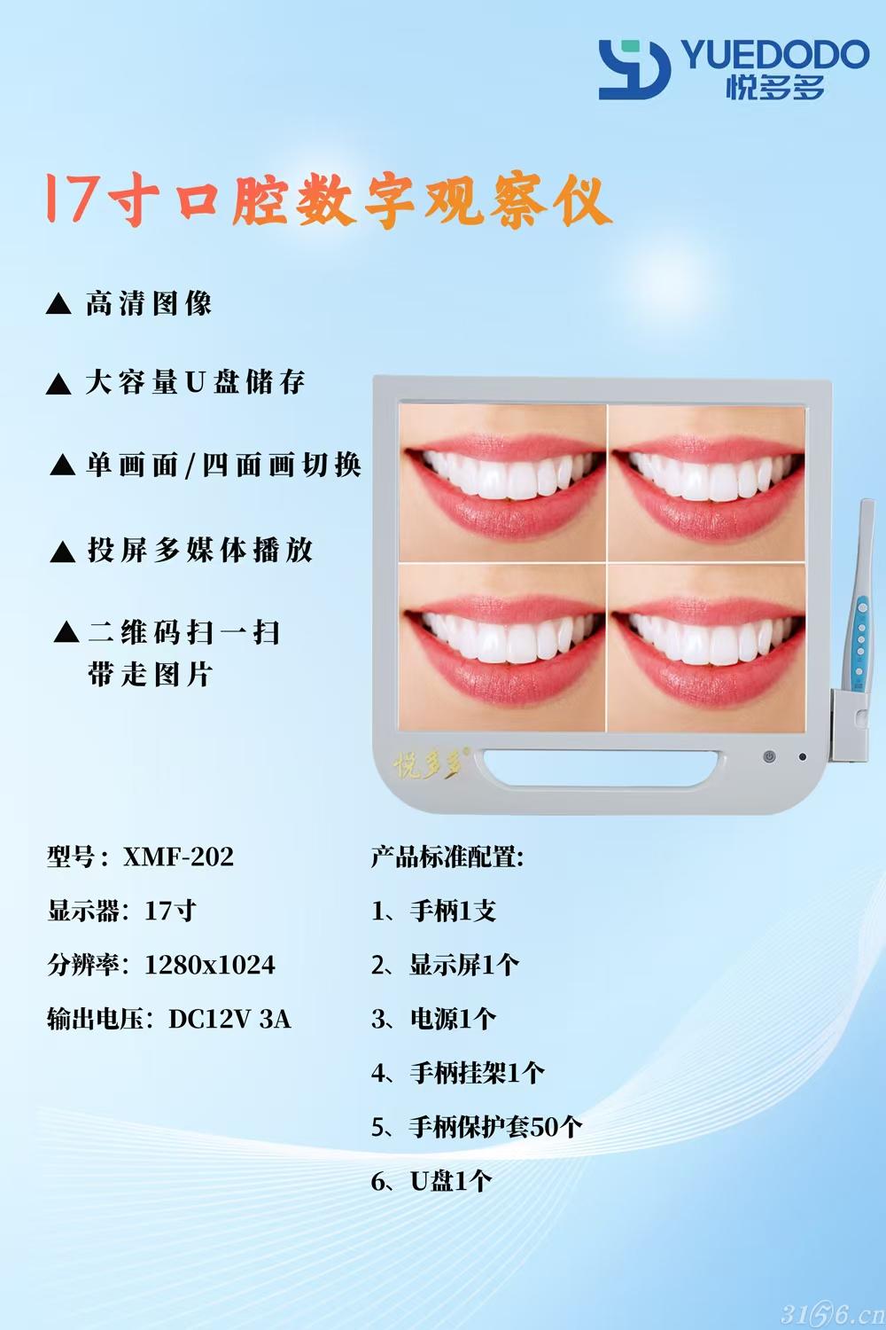 悦多多17寸口腔数字观察仪/内窥镜招商